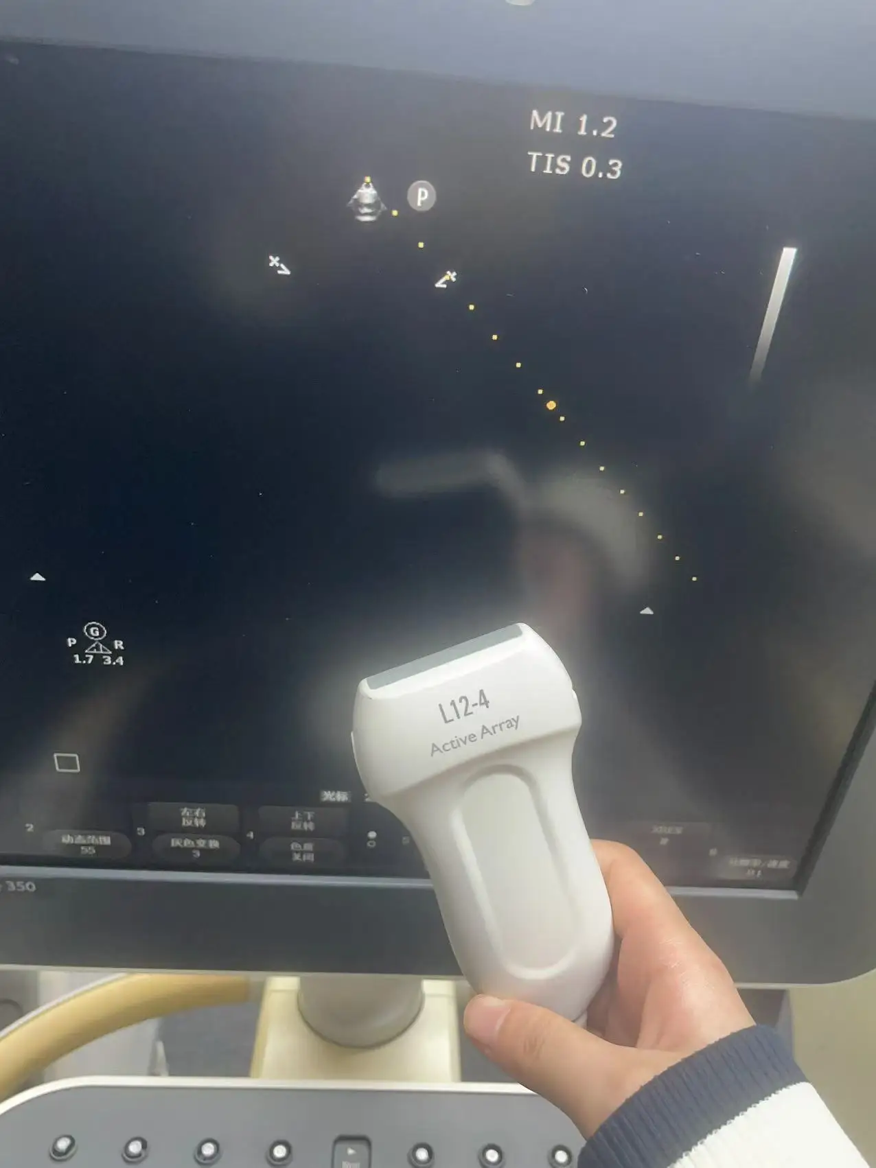 Philips ClearVue 350 Side
