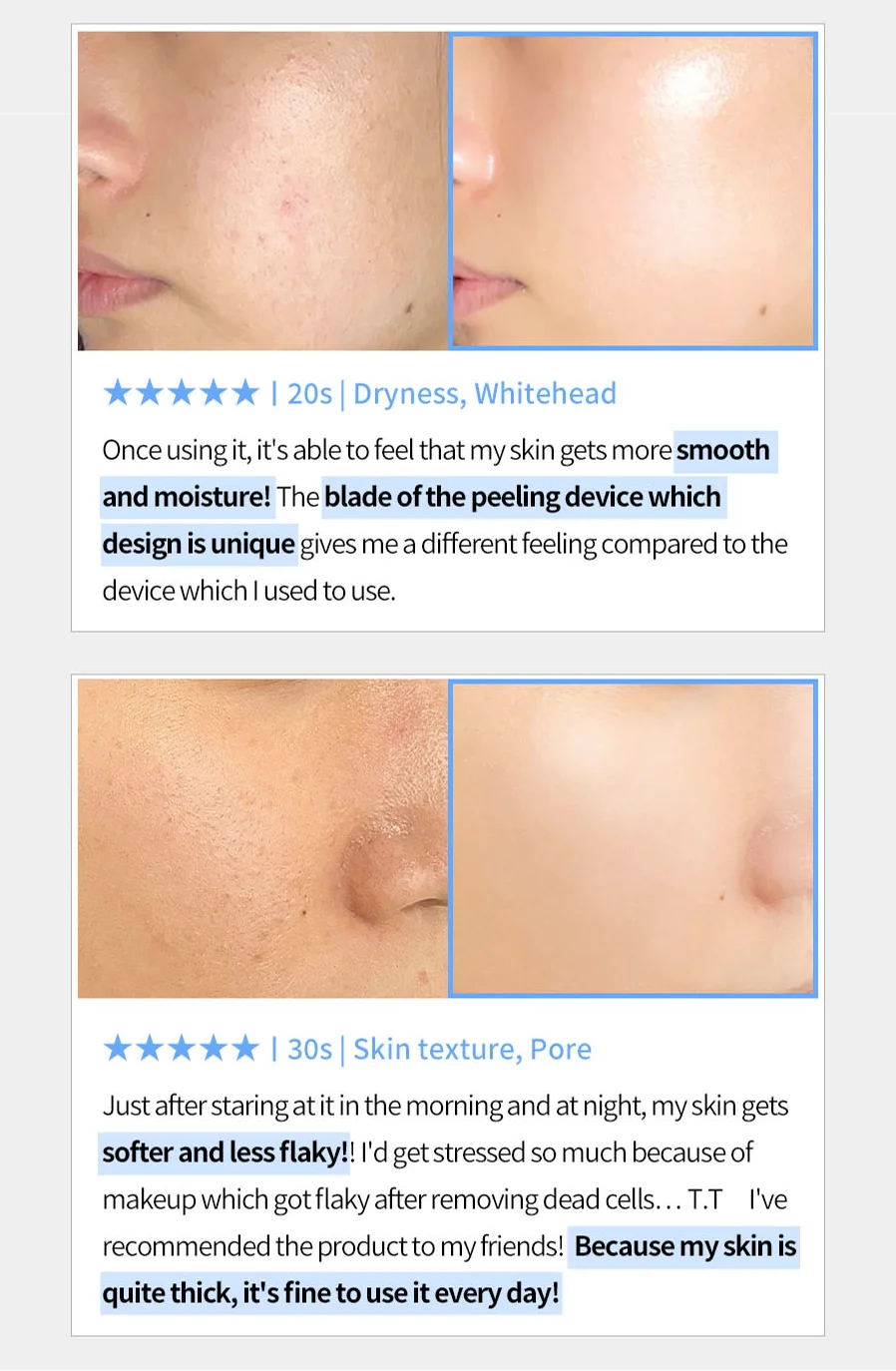 Face Factory Galvanic Z Waterpeeling Machine [made In Korea/beauty