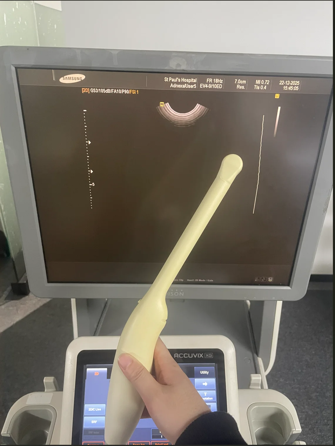 Samsung Accuvix XG Back