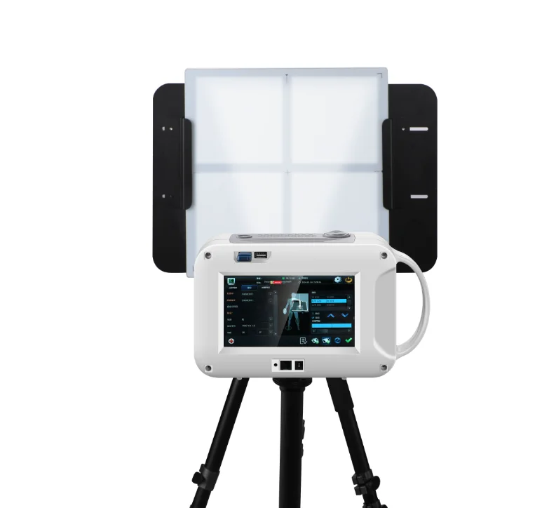 Portable Handheld X Ray Machine - Reliable Medical Radiography