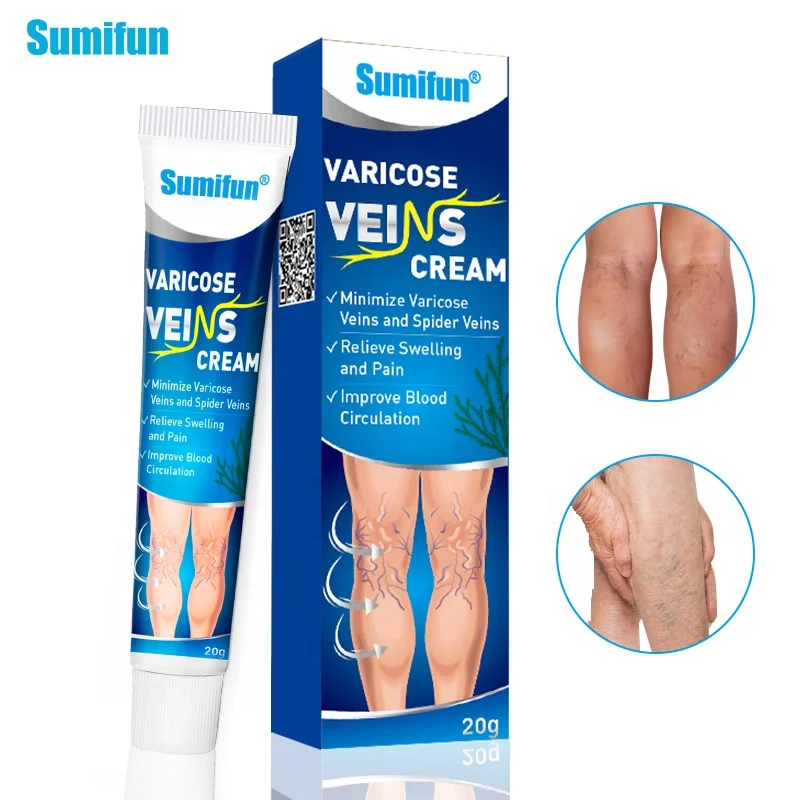 100% Original Varicose Veins Ointmnet Vasculitis Phlebitis Spider Pain  Relief Ointment Medical Plaster Angiitis Removal - Buy 100% Original Varicose  Veins Ointmnet,Vasculitis Phlebitis,Spider Pain Relief Ointment Product on  Alibaba.com