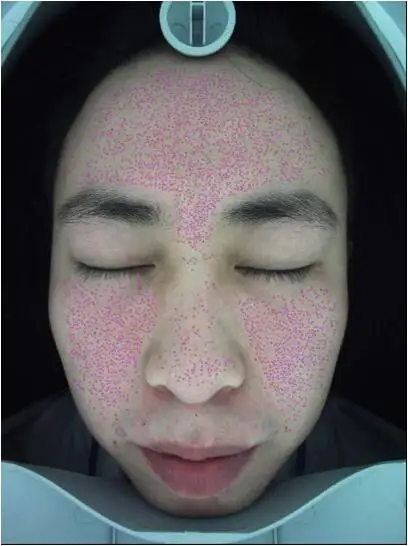 Professional Skin Analysis Machine With 3D Function CE Certificate