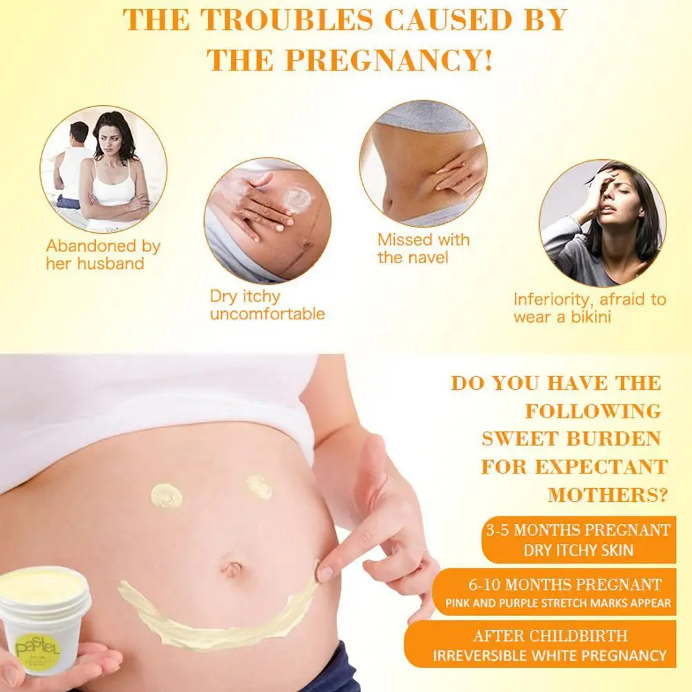 pasjel for stretch marks