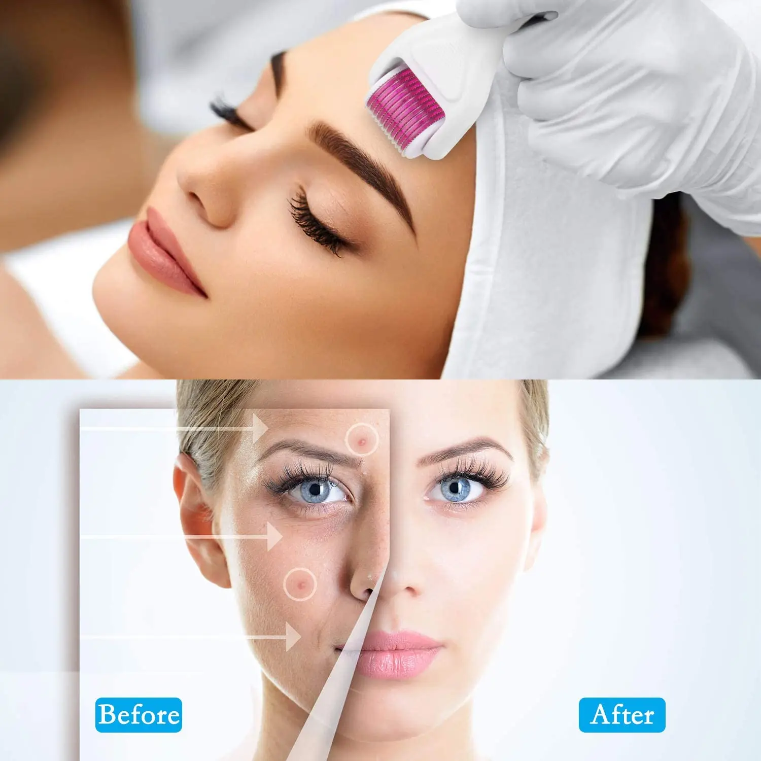derma roller fine titanium