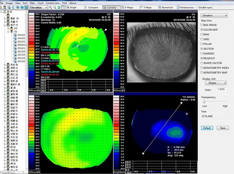 SW-6000 Cheap Price Ophthalmic Topographer Equipment China Corneal Topography