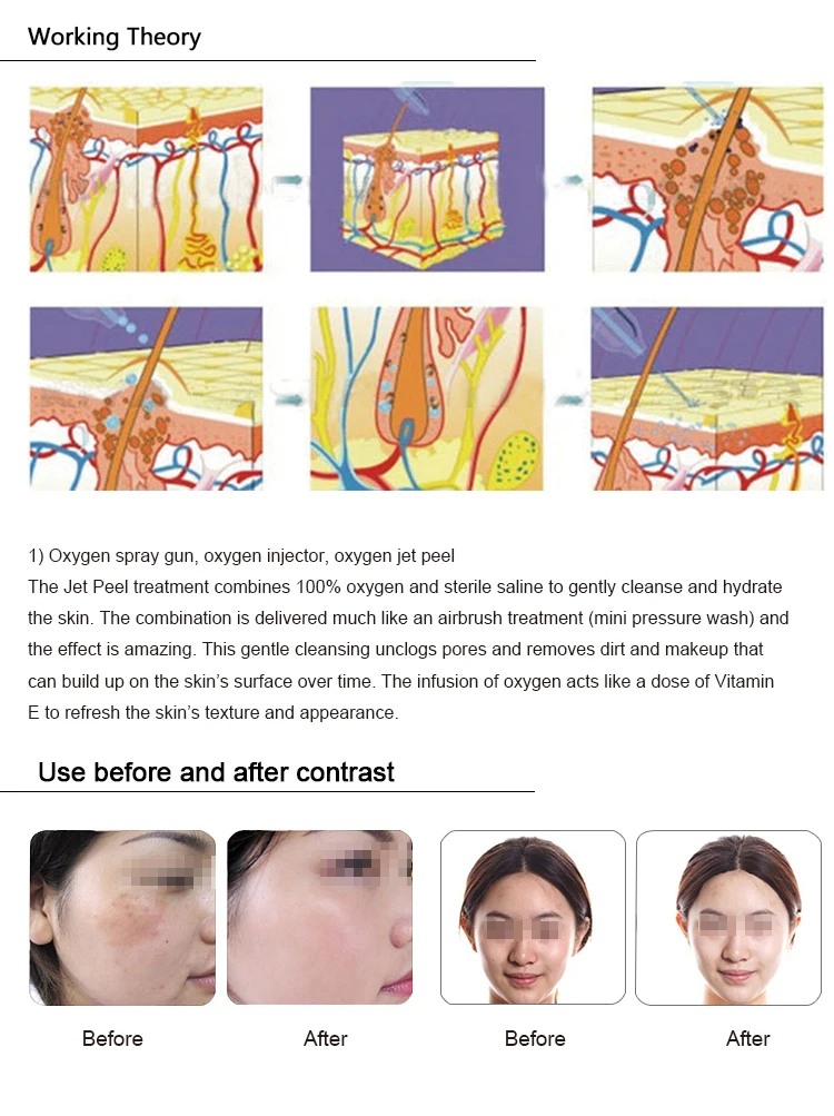 Micro Dermabrasion High pressure jet spray peel with superfine nozzle to peel superficial skin layers care device.jpg