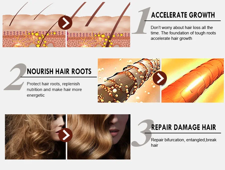 Disaar 30ML Natural Hair Loss Treatment Hair Growth Essential Oil for Men and Women Private Label