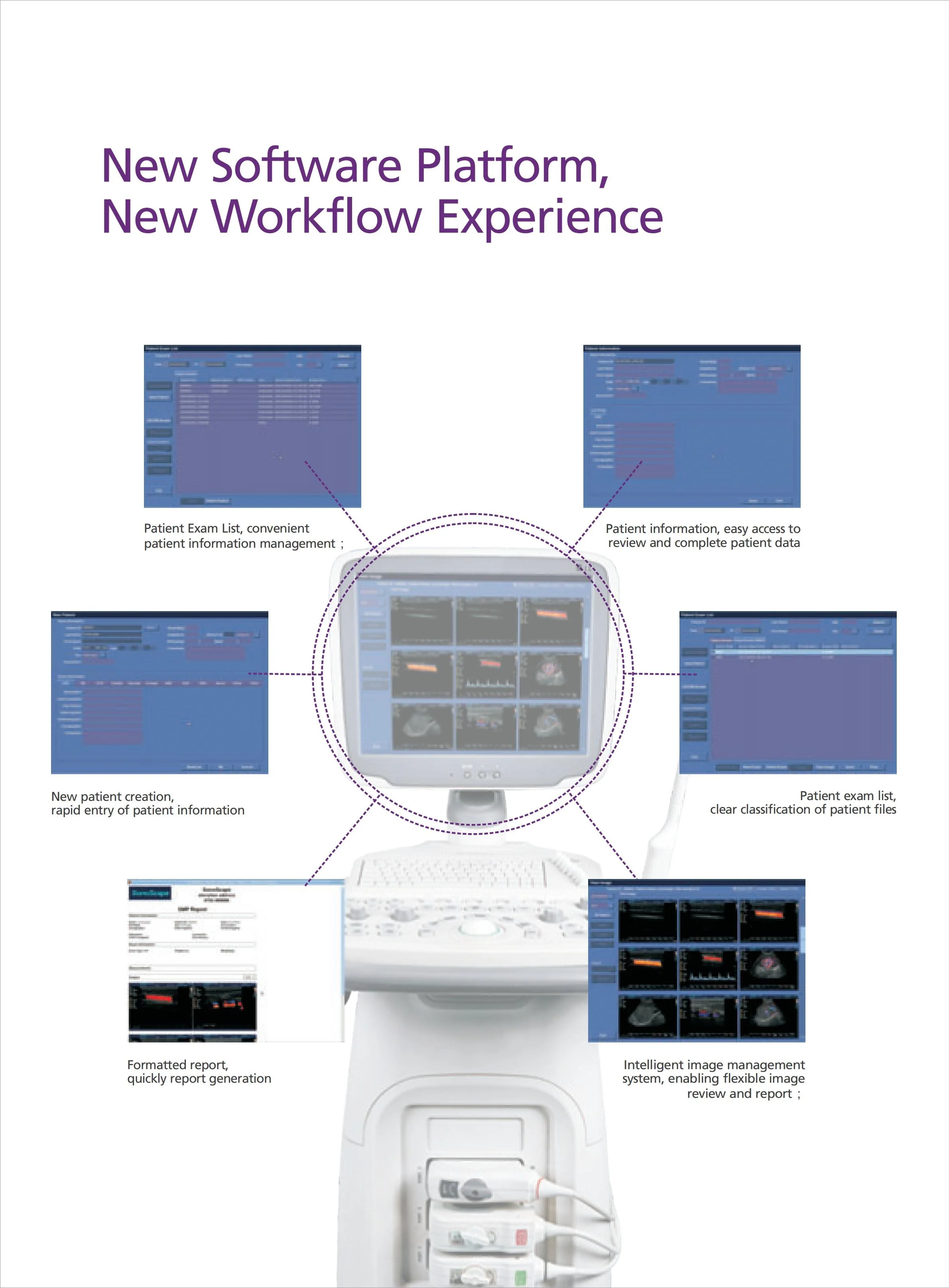 Sonoscape S11 Trolley Color Doppler Ultrasound system USG 15-inch High-Resolution Color LCD