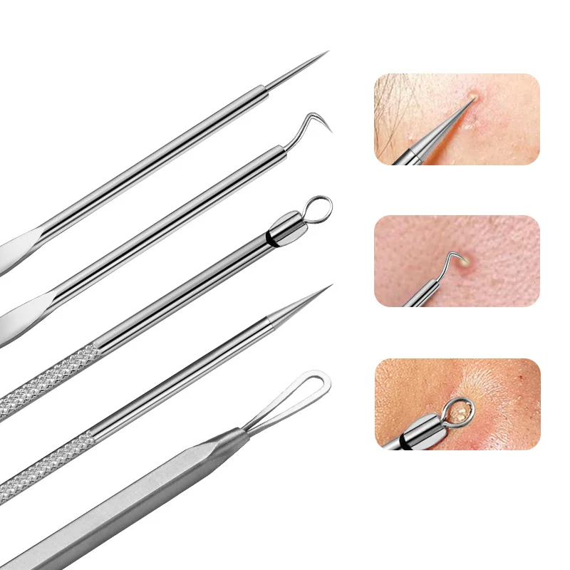 product factory hot sale stainless steel pimple remover blackhead pin blackhead remover  tool884-3