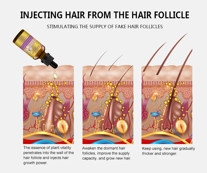 Disaar 30ML Natural Hair Loss Treatment Hair Growth Essential Oil for Men and Women Private Label
