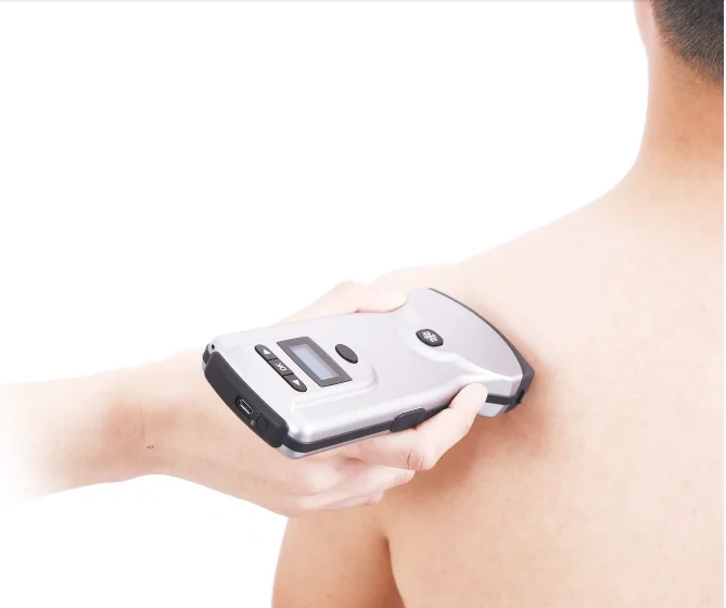 无线连接手持便携式无线超声波探头为新生儿肺