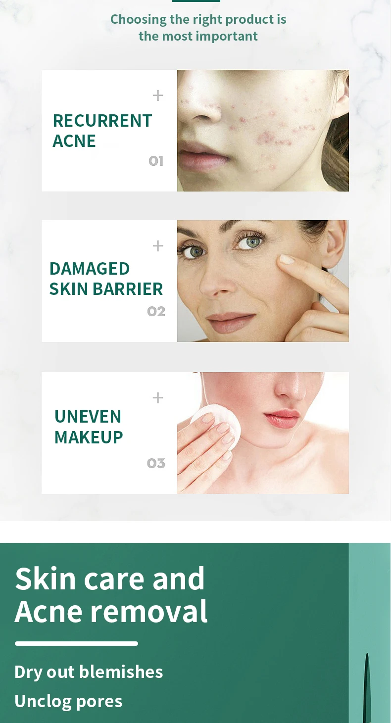 Private Label Korean Acne Scar Removal Face Repair Herbal Oil Control Lightening Whitening Acne