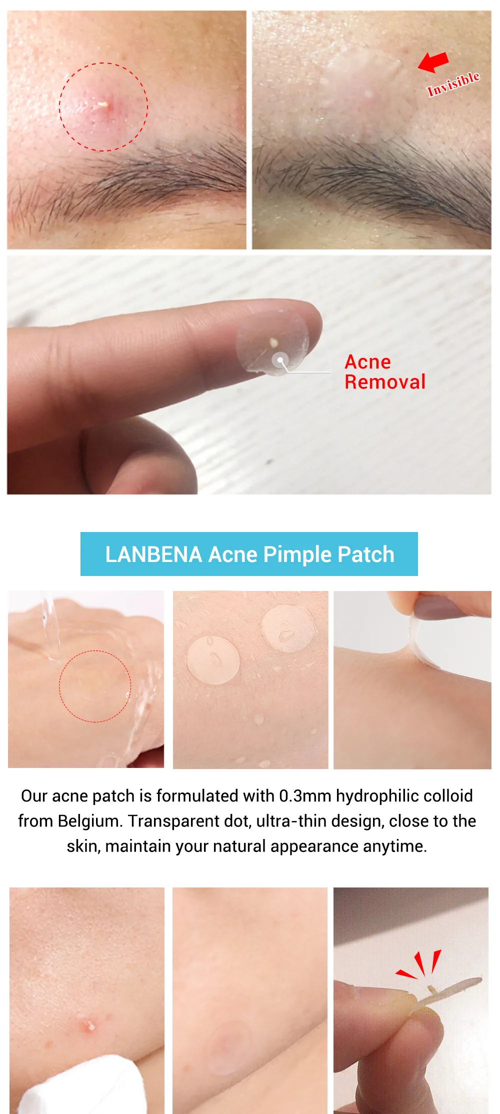 Removal Acne Patch (13).jpg
