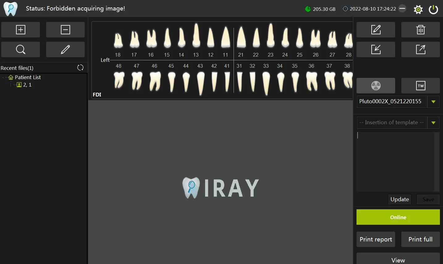Ce Approved Iray Ultrathin Digital Intraoral Size 2 Cmos Sensor Dental