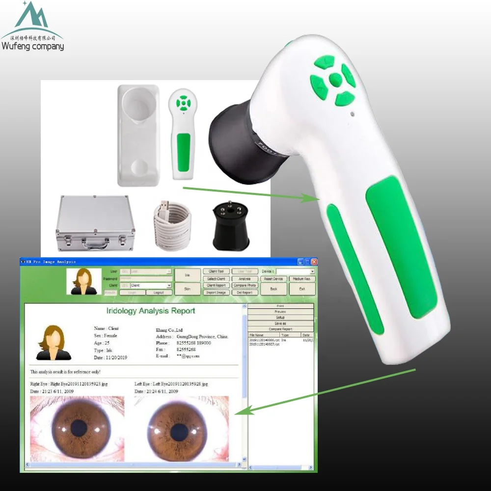iris-iriscope-iridology-camera-5.jpg