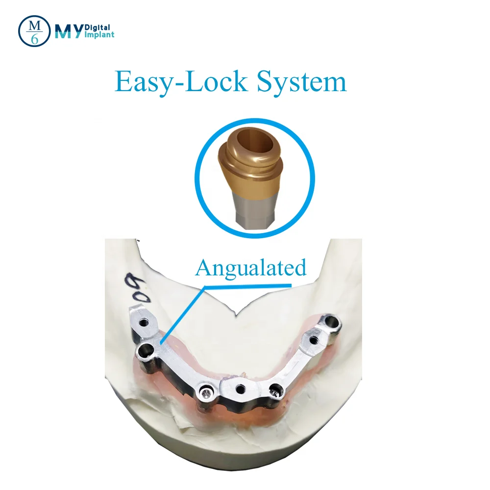 China M6 Anthogyr Implant Compatible Titanium Dental Locator Abutment