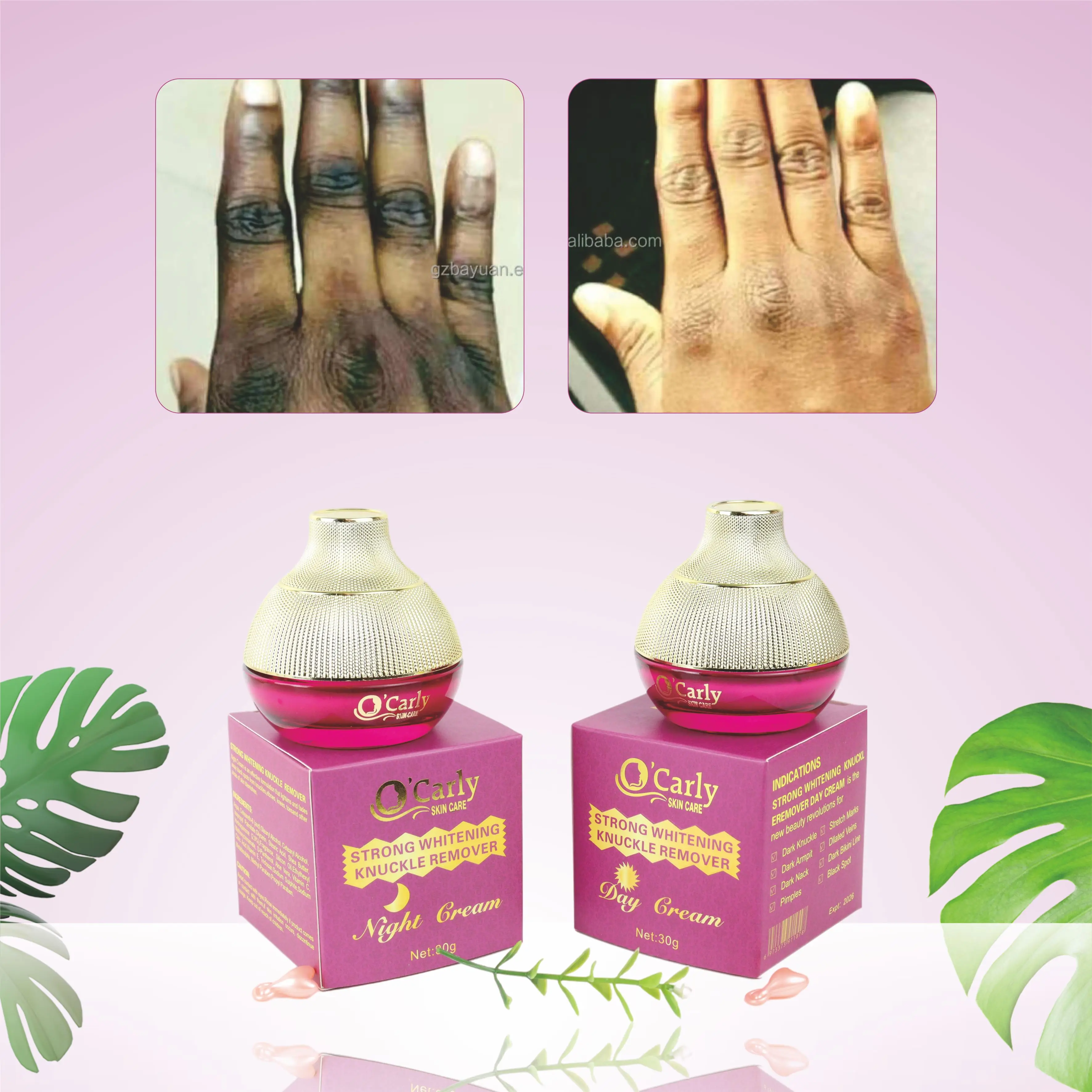 Knuckles Cream Ultra White Lightening & Regenerating Dark Knuckles Removal Cream For Black Spot