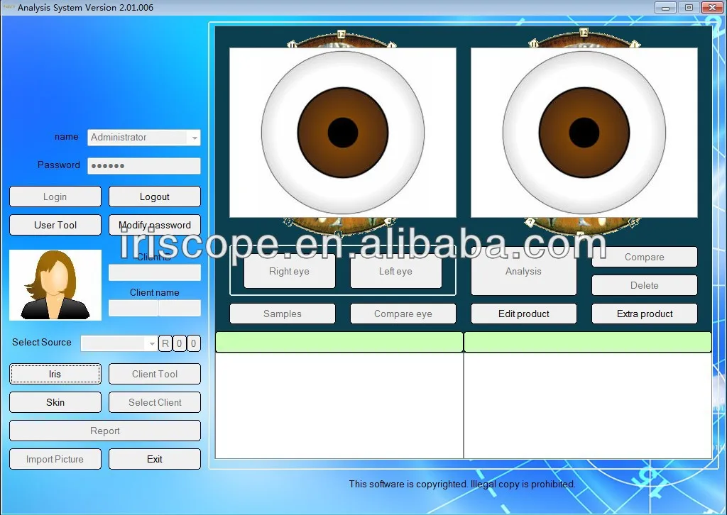 Usb Iridology 카메라 5 메가 픽셀 디지털 Iriscope - Buy 디지털 Iriscope,Usb Iridology ...