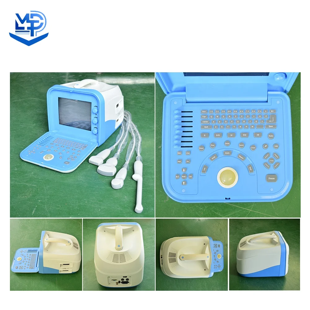 Full Digital Portable Ultrasound Scanner Medical Ultrasound Instruments  machine uptodate medical factory