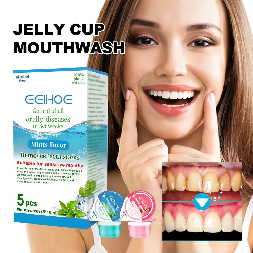 New Hot Remove Teeth Stains Fresh Breath Dental Teeth Whitening ...