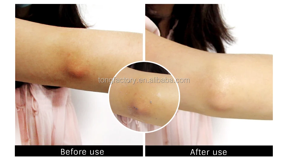 omy lady blackhead deep cleansing oxygen foam