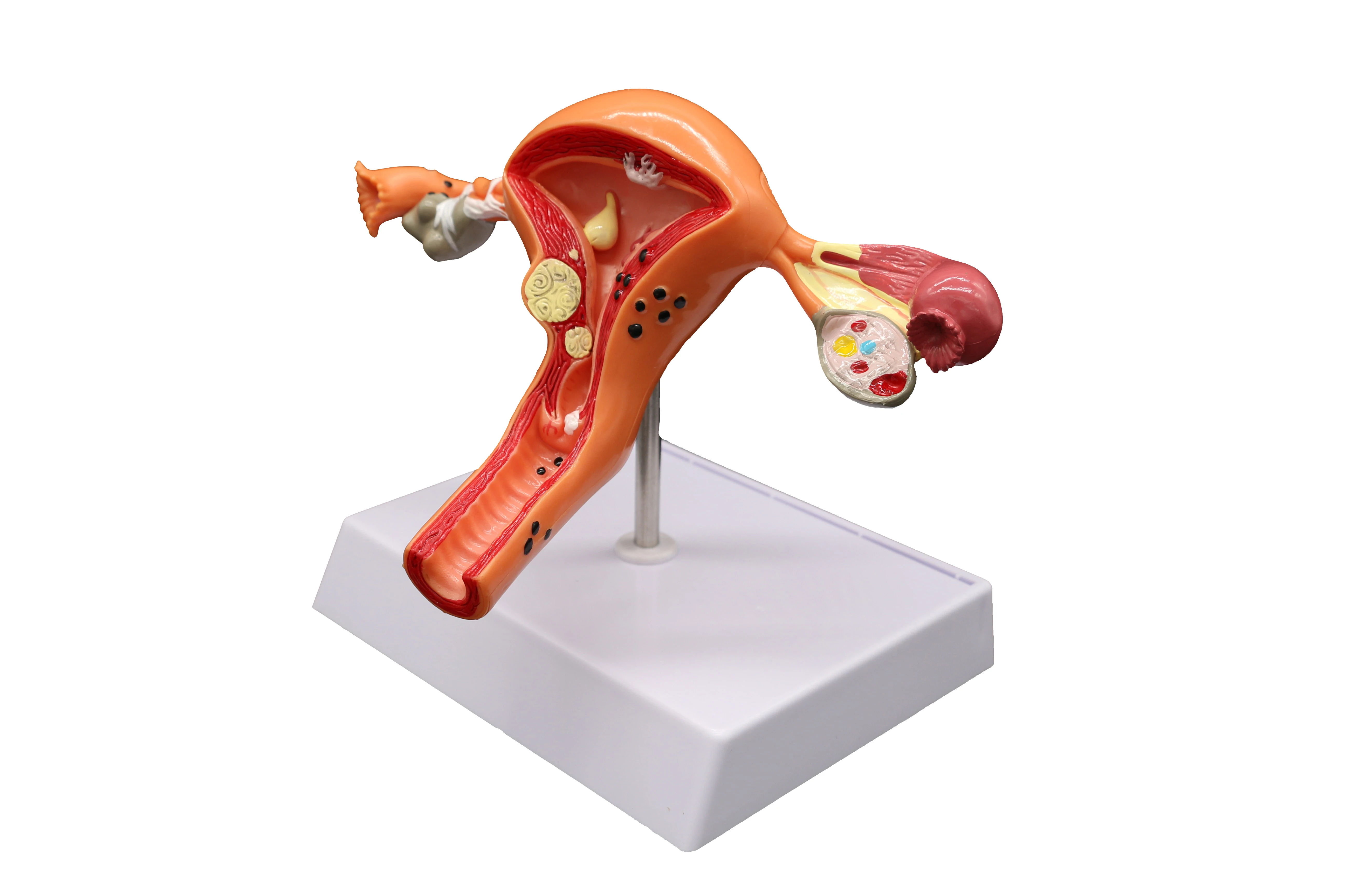 Female Internal Genital Organs Uterus Anatomical Model - Buy Uterus ...