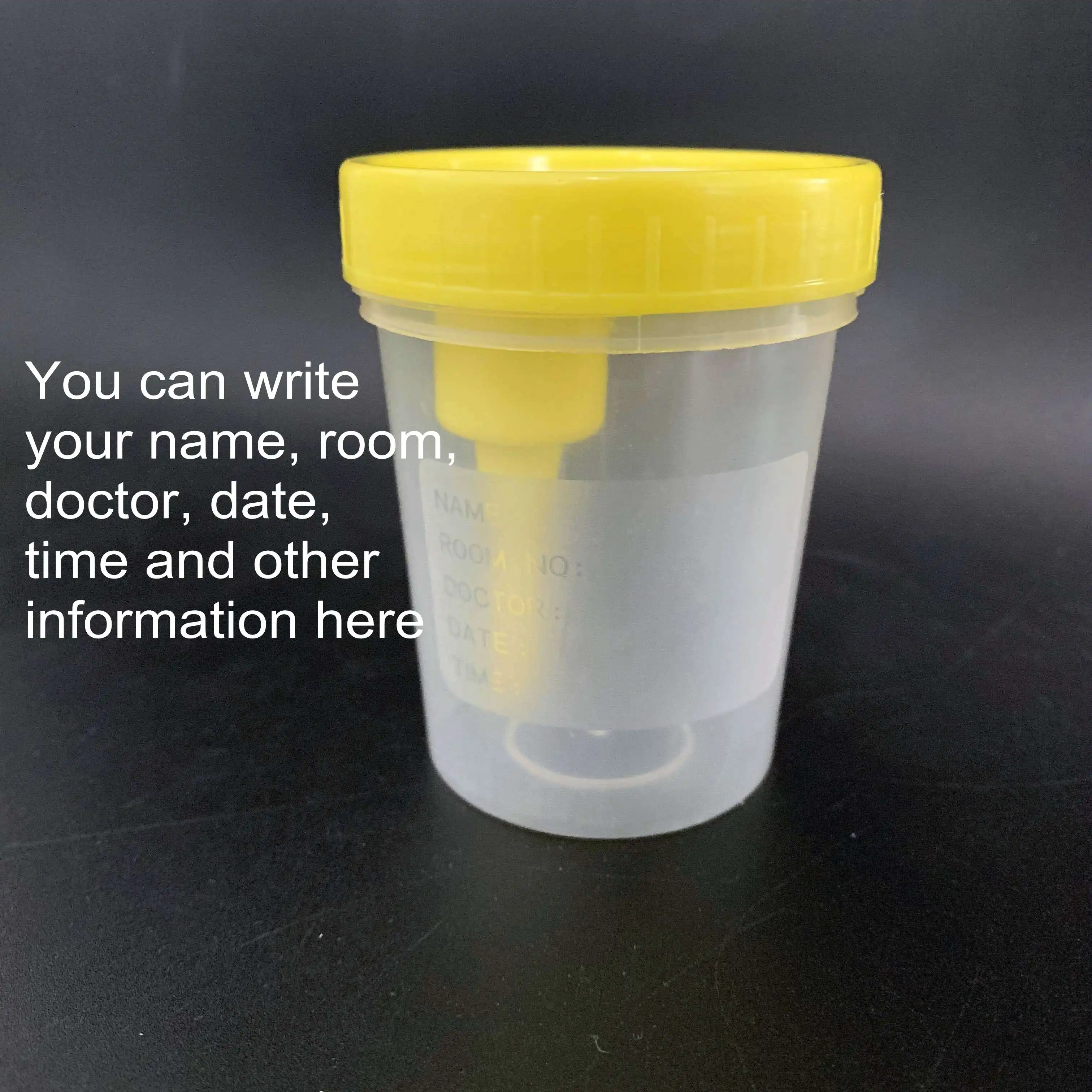 Sterile 120ml urine container with vacuum tube disposable medical urine cup supplier