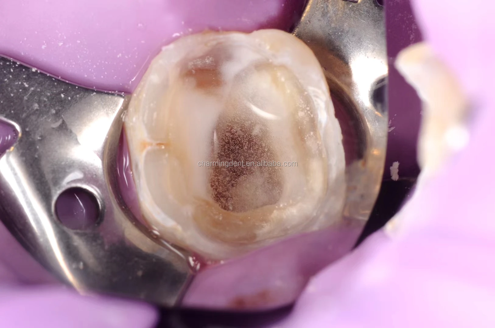 Endodontic Ultrasonic Endo Activator Irrigator / Root Canal Endodontic