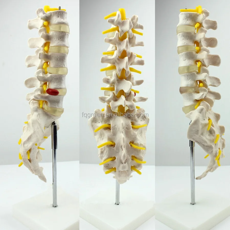 Lumbar Vertebrae Sacum With Nerves Model - Buy Lumbar Vertebra/ Nervi ...