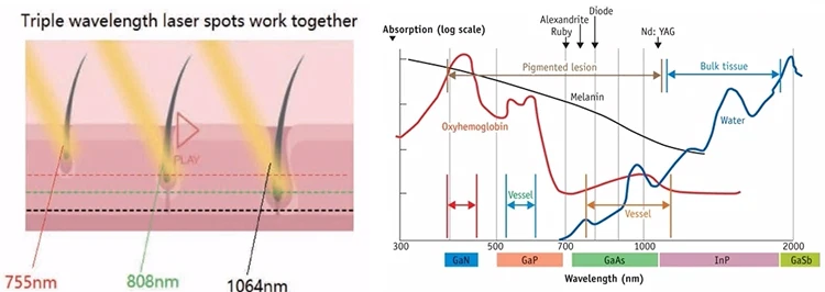 755 808 1064 diode laser
