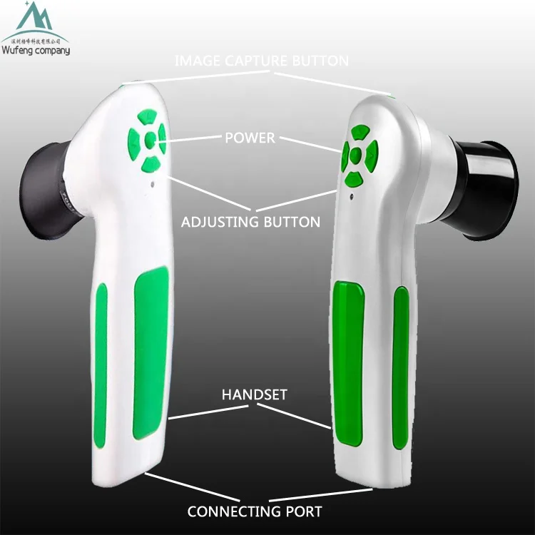 iris-iriscope-iridology-camera-2.jpg