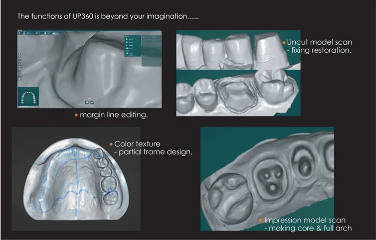 Scanner dentaire 3D, grossissement à 360 degrés, up3d