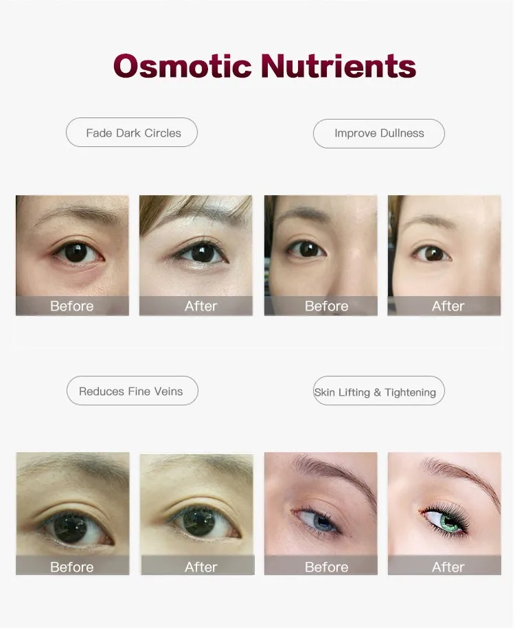 2023 New Beauty Product Ems Microcurrent Anti Wrinkle Eye Care Massage Machine