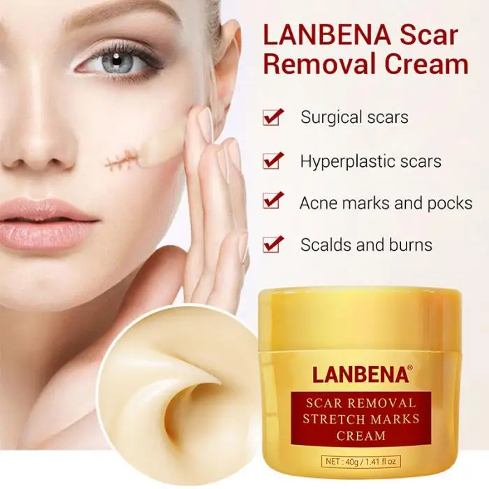 lanbena stretch mark