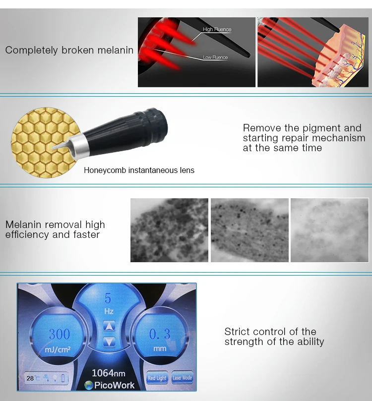 q switched nd yag laser tattoo removal machine