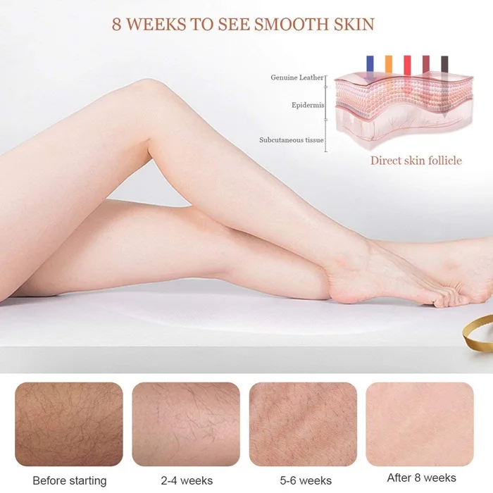 IPL Hair Removal (4).jpg