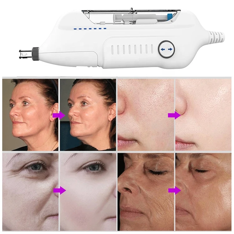 price portable skin care device water meso mesotherapy injector
