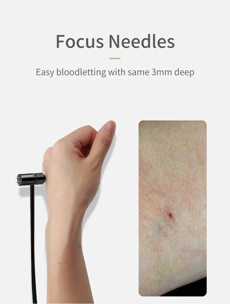 Disposable Sterile Dermal Hammer Needle Plum Blossom Needle Therapy