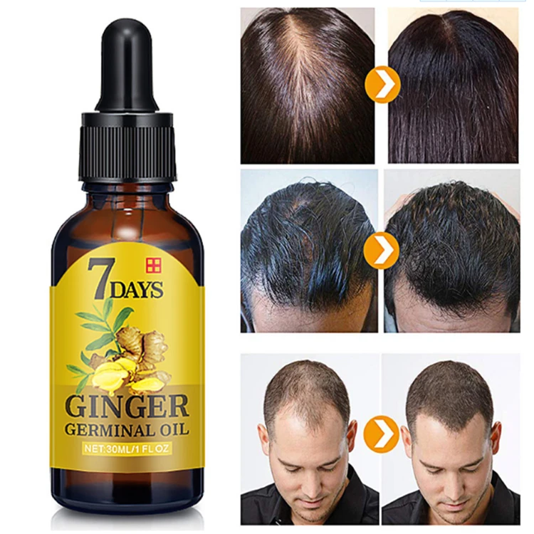 Yanmei Castor Oil Hair Growth Serum 7 Days Hair Growth Ginger Spray