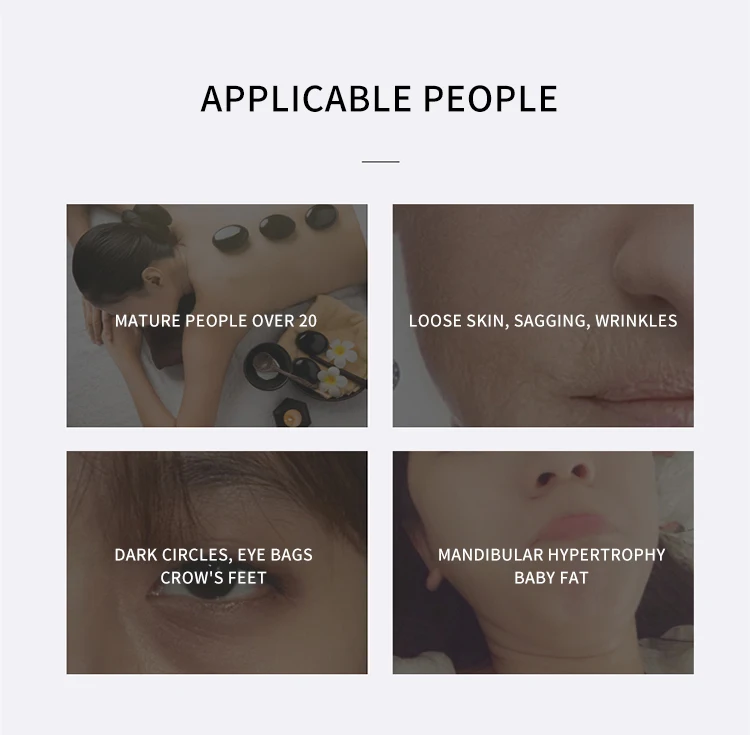 4 IN 1 RF+Ultrasound+Ion Anti-aging Beauty Machine Face Lift Skin Firm Reduce Wrinkles Collagen Revitalization Skin Rejuvenation