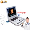 Best ecografo 3D 4D portable ultrasound price list medical equipment ultrasound