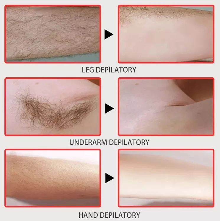 Aixin Oem Private Label Natural Quick Legs Permanent Armpit Private