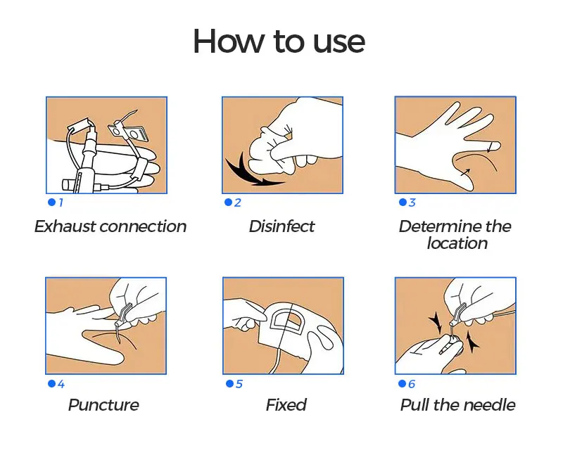 Medical Disposable Safety Huber Needle 19G 20G 21G 22G Disposable Huber Port Needle manufacture