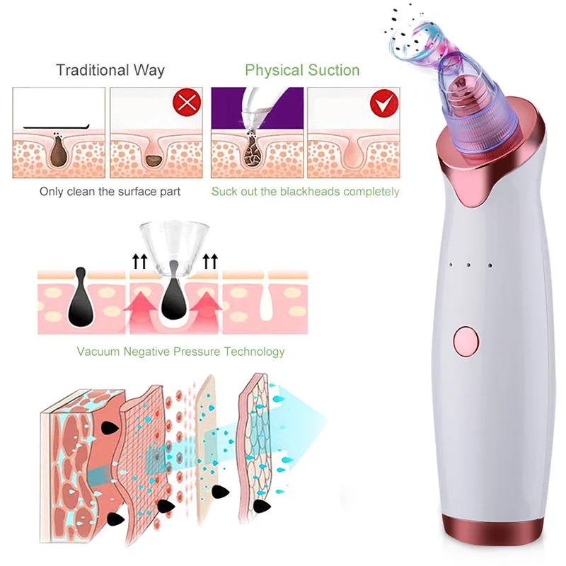 Blackhead-Vacuu(8).jpg
