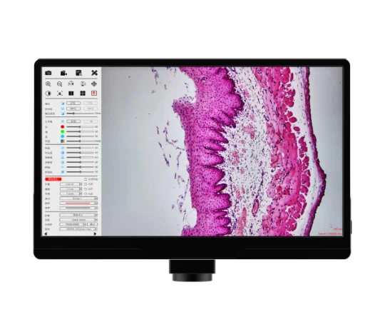 Labonos 11 Inch Digital Biological Microscope Screen with 40X~100X LCD ...