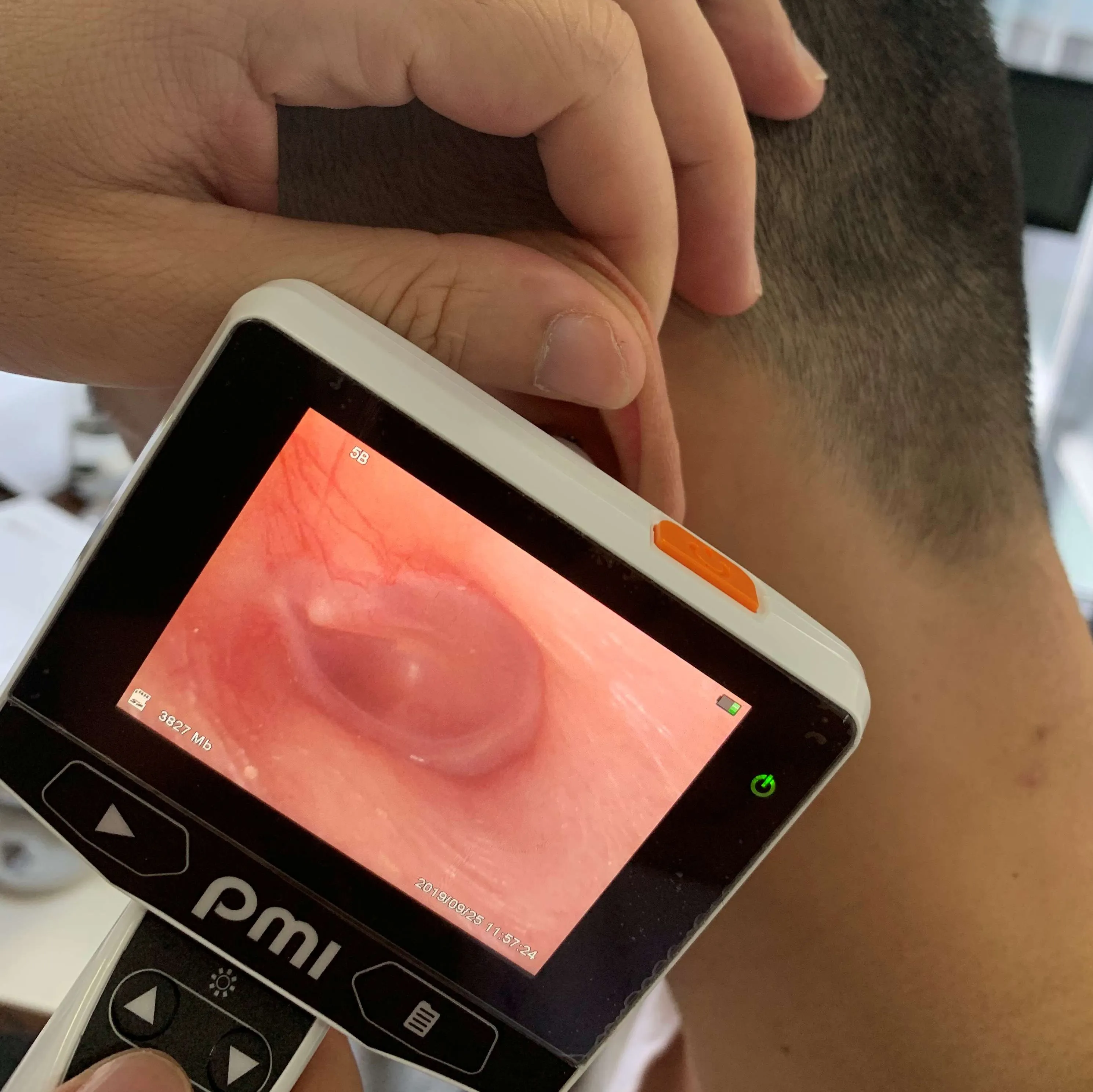 high quality digital hd video otoscope usb endoscope otoscope