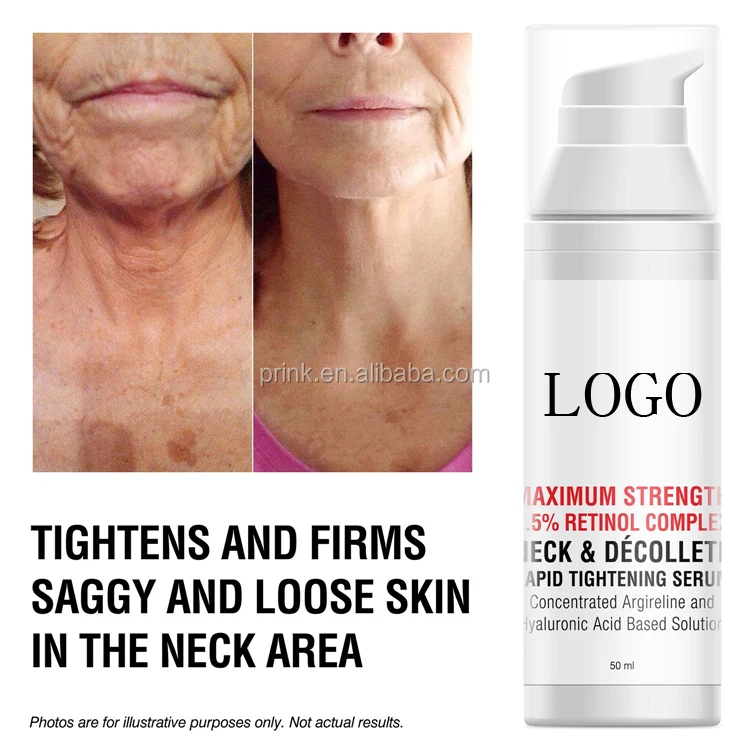 saggy neck cream