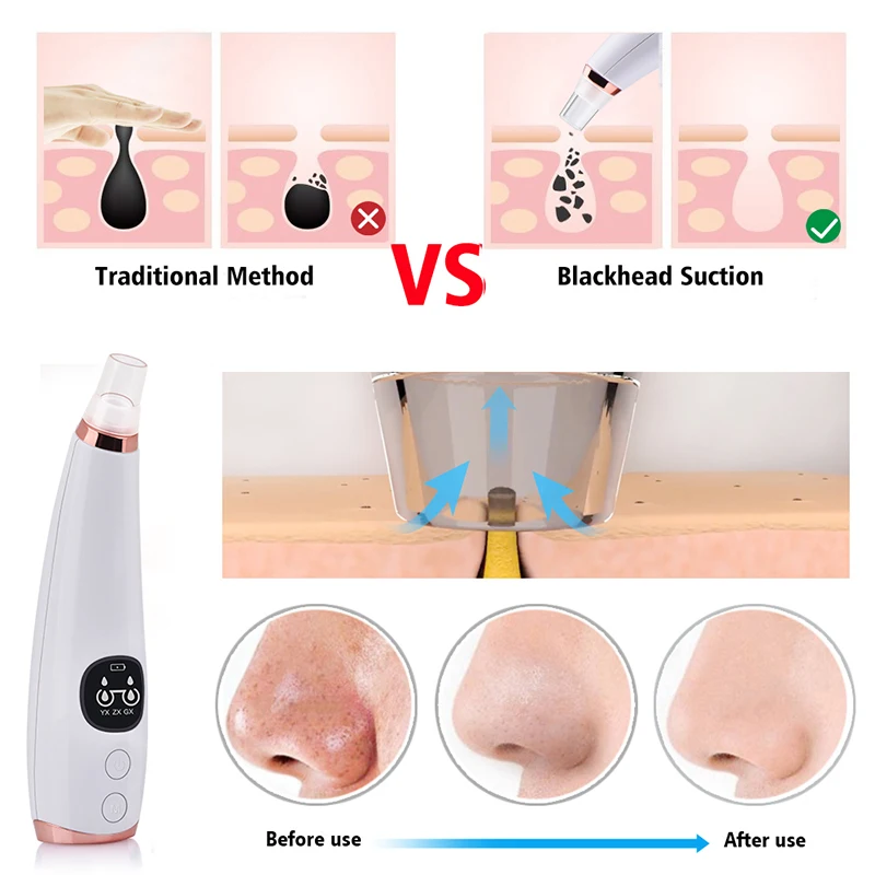 Teenager Korean Uk Blackhead Removal Electric Facial Skin Care Pore