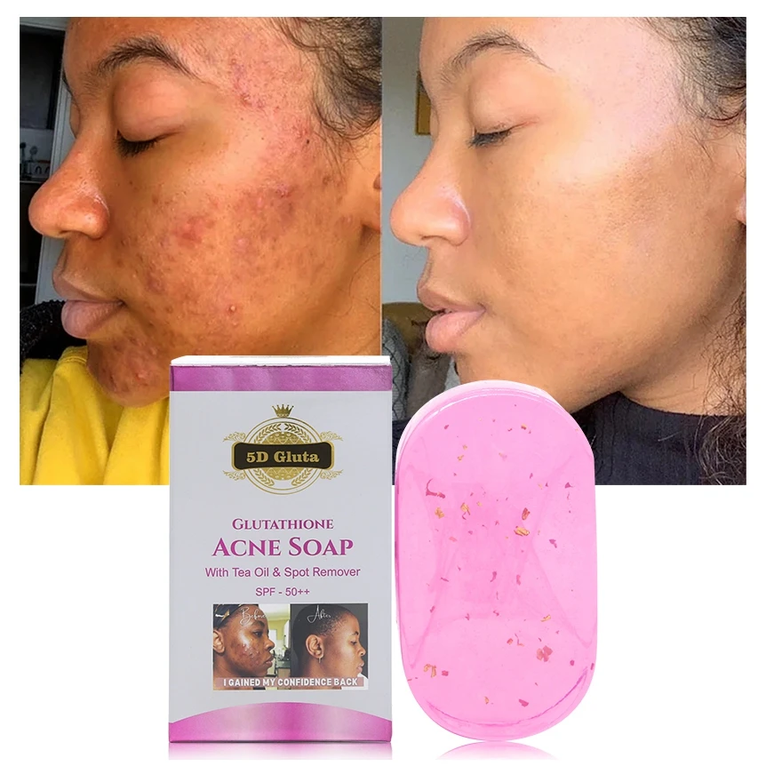 glutathione soap breakout Organic Tea Oil Glutathion Face Anti Acne Dark Spots Remove Deep Cleansing Glowing Natural Handmade Whitening Soap Ishigaki Glutathione Capsules, 1000