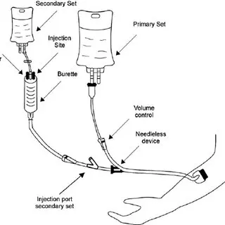 Medical Disposable Sterile Iv Burette Set With 100cc/150cc Chamber Ce ...